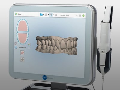 iTero Digital Impressions Dr. Zoey Orthodontics in Vero Beach, FL