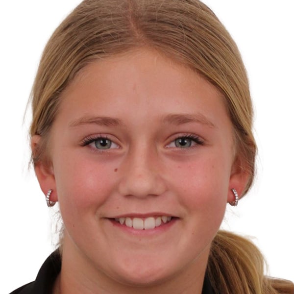 Before Orthodontic Treatment Dr. Zoey Orthodontics in Vero Beach, FL